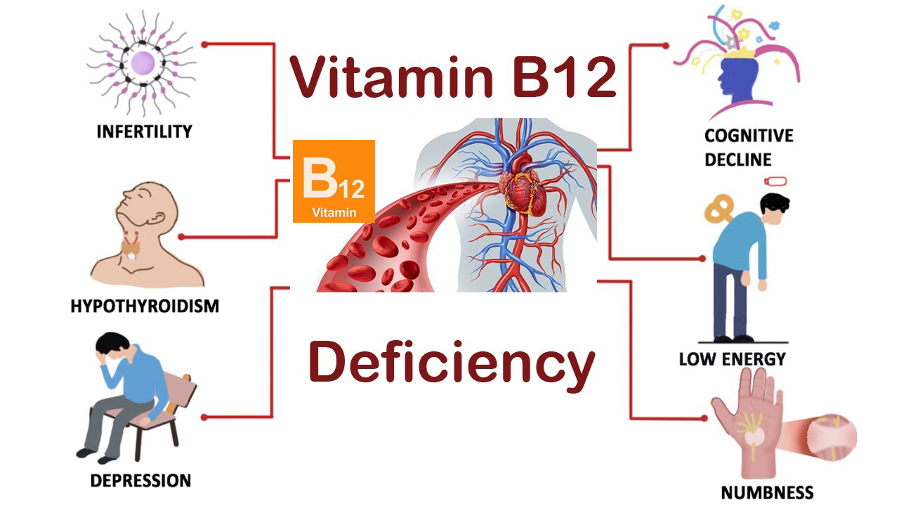 vitamin-b12-deficiency